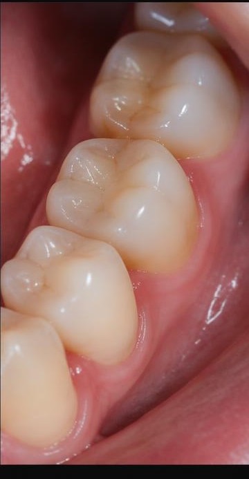 Fictional intraoral patient photograph